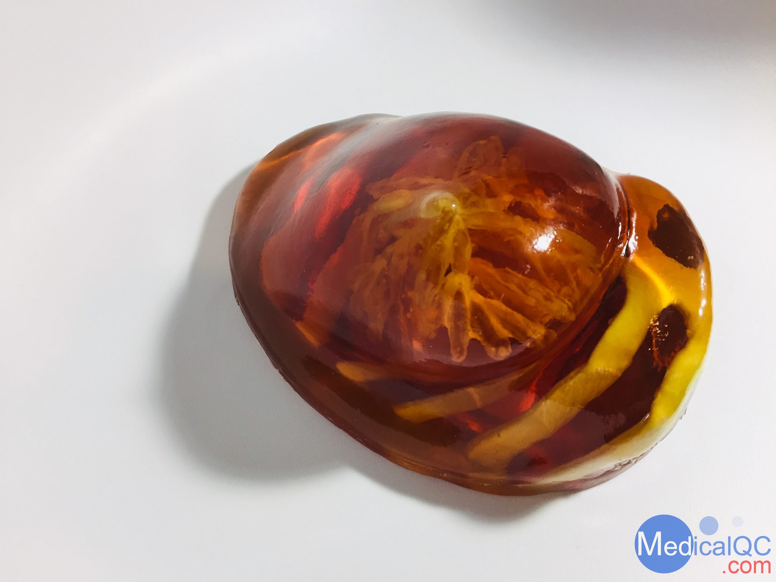 BT-A01乳房模體,BT-A01解剖乳房模體,Breast Phantom