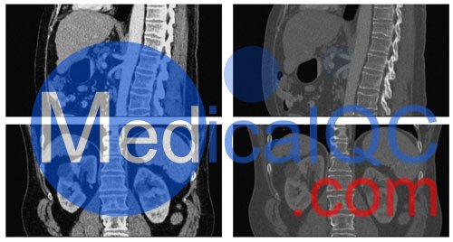 WEK53-04肝硬化腹部模體,WEK53-04門(mén)靜脈期腹部模體