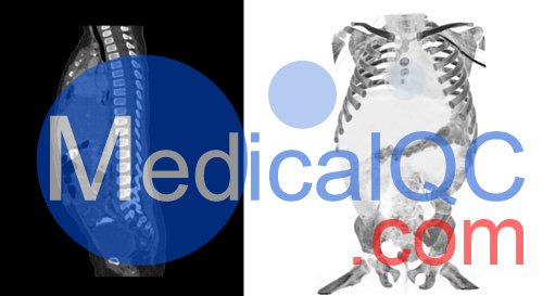 WEK58-03兒童軀干模型,WEK58-03兒童軀干模體